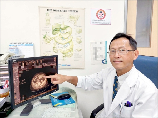 1130828自由-多日腹痛  竟是罕見10CM小腸癌