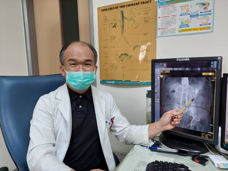 腹痛又血尿  泌尿道細菌感染釀感染性腎結石